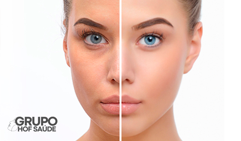 Skinboosters: Hidratação e Luminosidade que Transformam Sua Pele